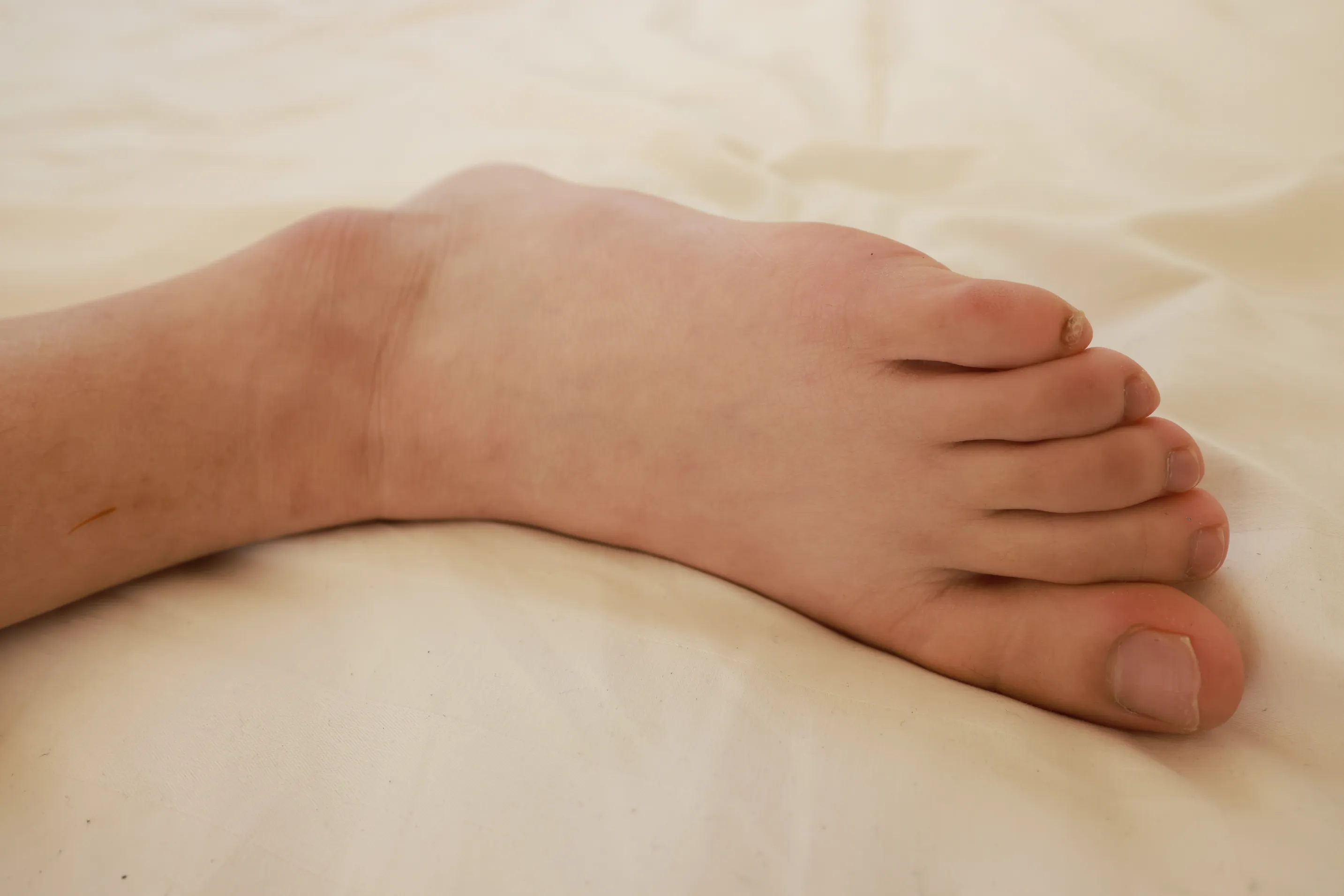 [Mzsock] Love beautiful feet NO.261 Yanyan#[95P]-4